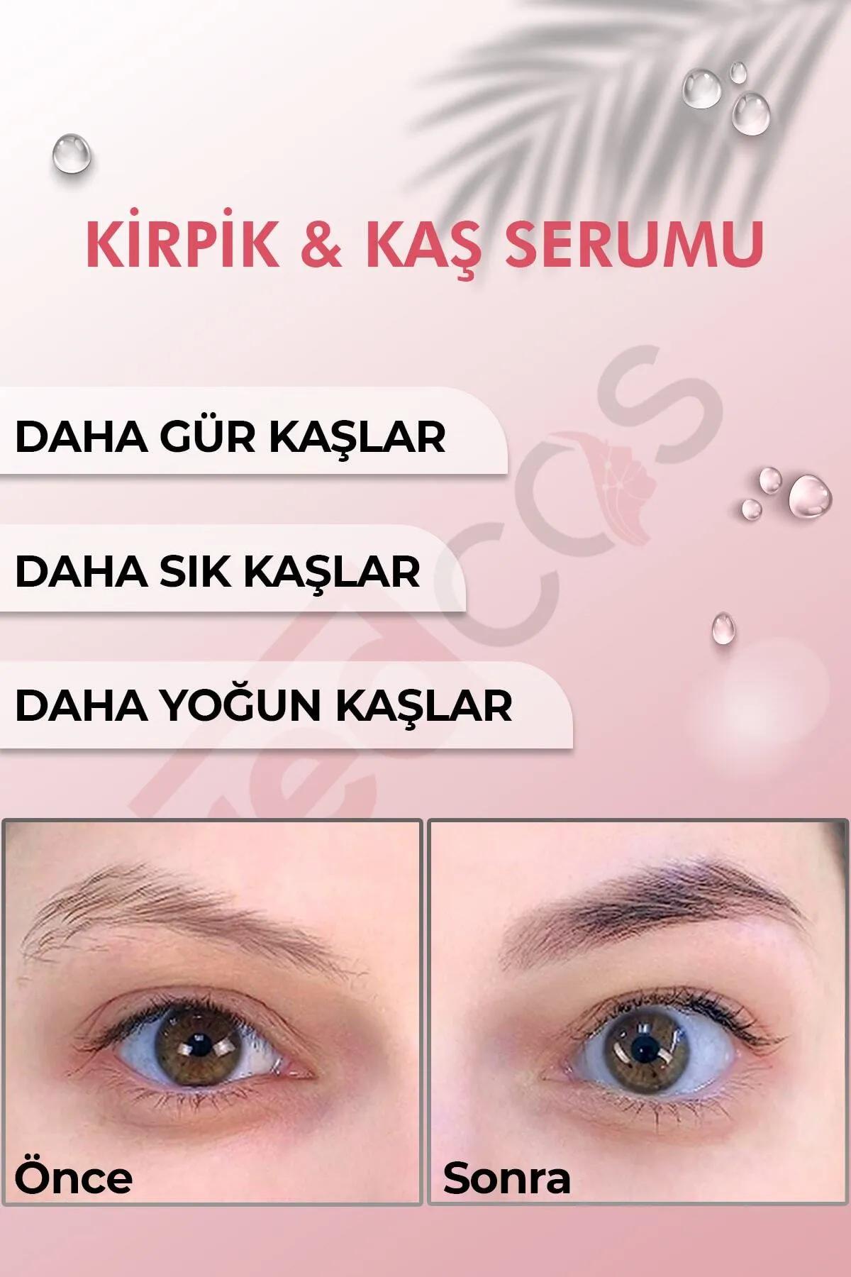 Ürün Resmi 5