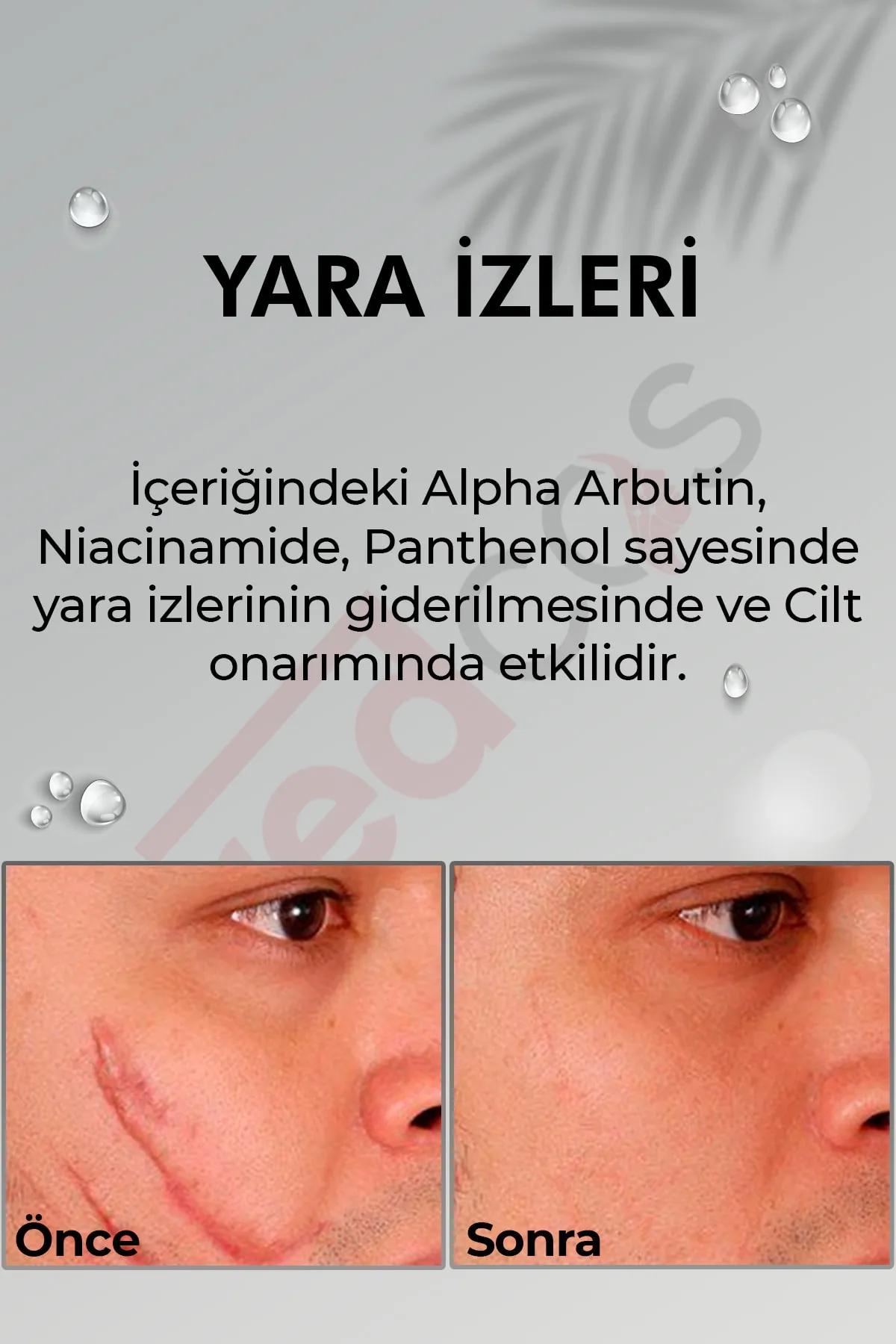 Ürün Resmi 7